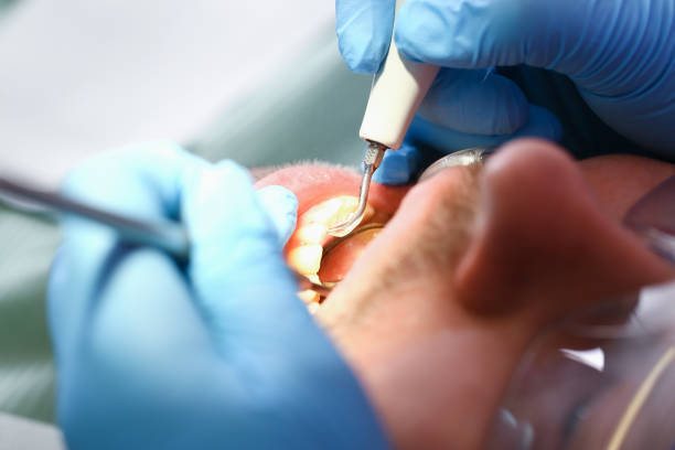 Best Knocked-Out Tooth Emergency  in Mccoll, SC