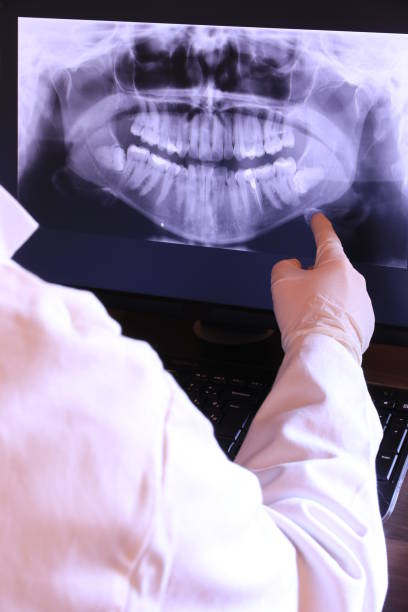 Emergency Gum Pain Relief in SC